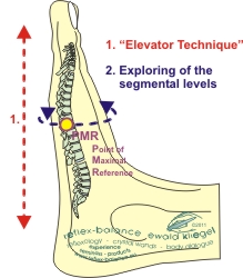 Elevator-Technique