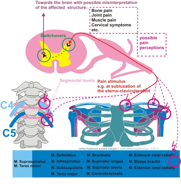 Reflexology - referred pain